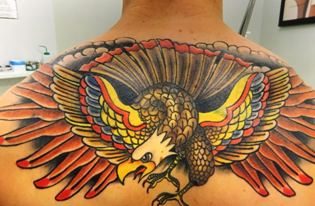 Atlantic Laser Tattoo Removal Tattoo CoverUps and