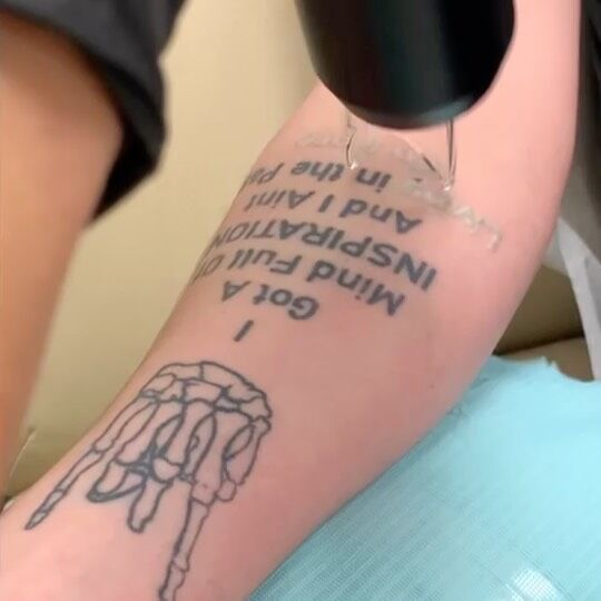 Atlantic Laser Tattoo Removal Tattoo Cover Ups And Tattoo Removal Atlantic Laser Tattoo Removal Tattoo Cover Ups And Tattoo Removal